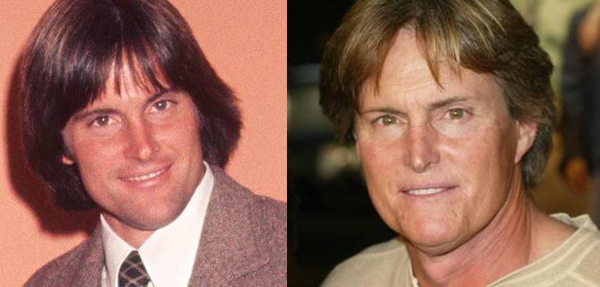 Bruce Jenner: Cosmetic Surgery increased his income?